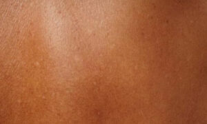 Assicurati di mantenere la tua pelle idratata prima e dopo l'esposizione ai raggi UV per prolungare l'abbronzatura e prevenire la secchezza cutanea